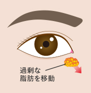 裏ハムラ 傷跡 イメージ