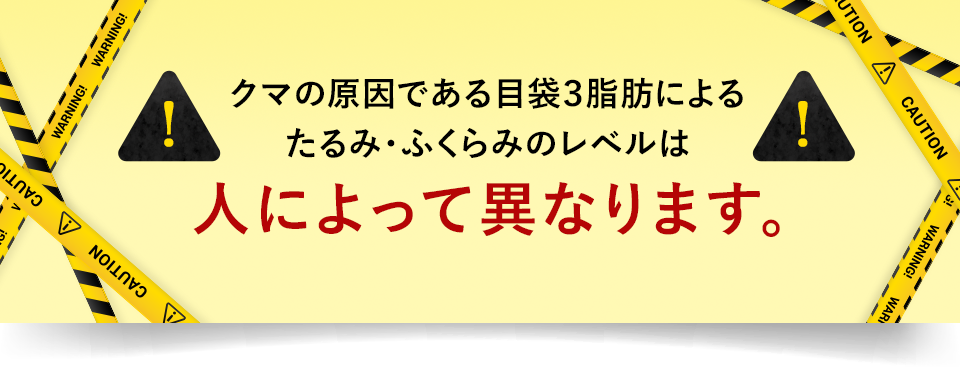 クマの原因である目袋3脂肪によるたるみ・ふくらみのレベルは人によって異なります。