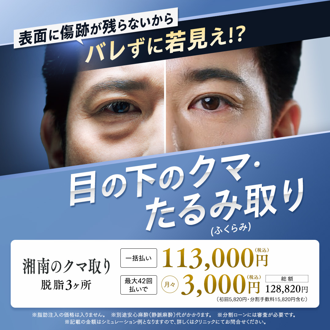 バレずに若見え!?目の下のクマ・たるみ（ふくらみ）取り