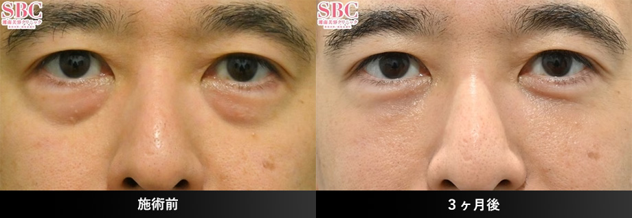 40代症例写真