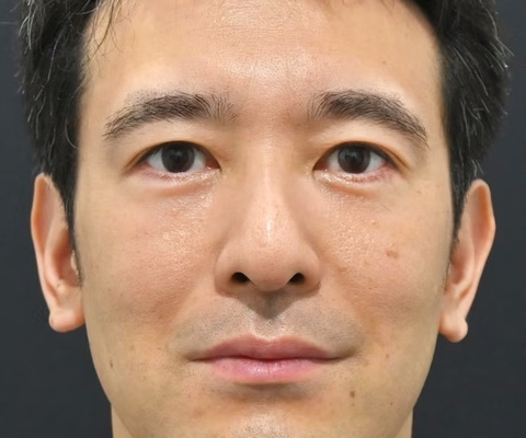 症例写真02_after