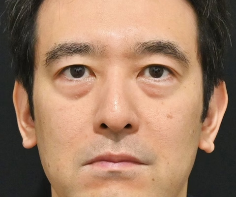 症例写真02_before