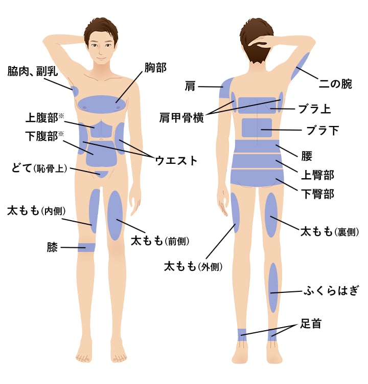 小顔用脂肪吸引注射の対象部位(体)