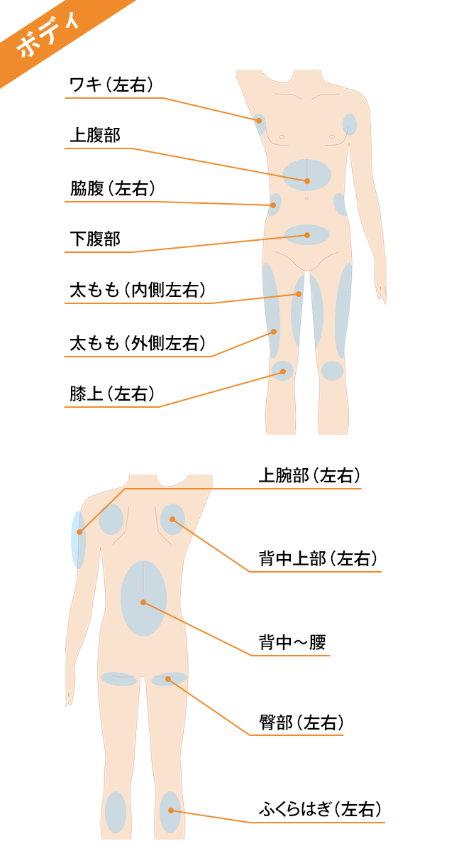 ボディ